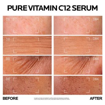 La Roche Posay Pure Vitamin C12 Serum 30 ml