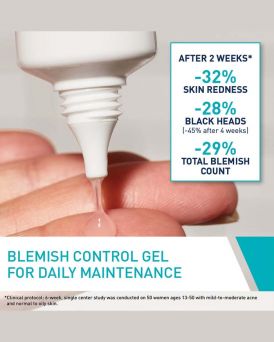 Dermatologist-developed acne treatment gel by CeraVe