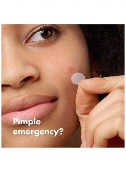 Close up of Hero Mighty Patch UAE overnight pimple patch applied to a whitehead.